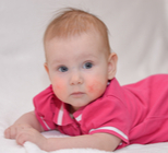 העונה הקרה: להגן על עור התינוק-תמונה